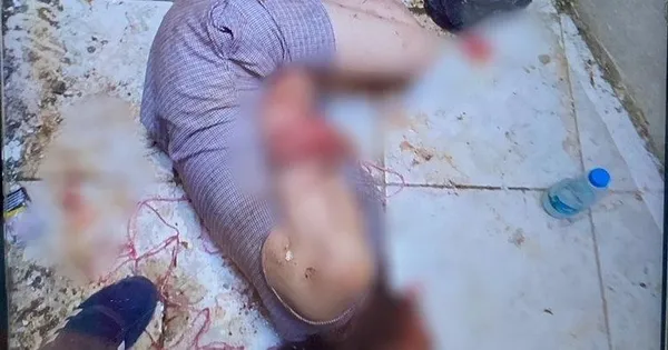 1628414185994.jpeg Kadıköy'de korkunç olay! Arkadaşları kanlar içinde buldu - 3