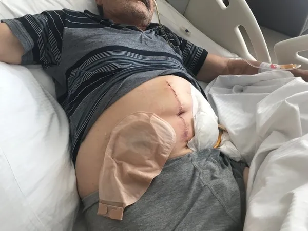 Kıbrıs Gazisi’ne acımasız dayak! Gaziye vurmayın sözlerine şok yanıt