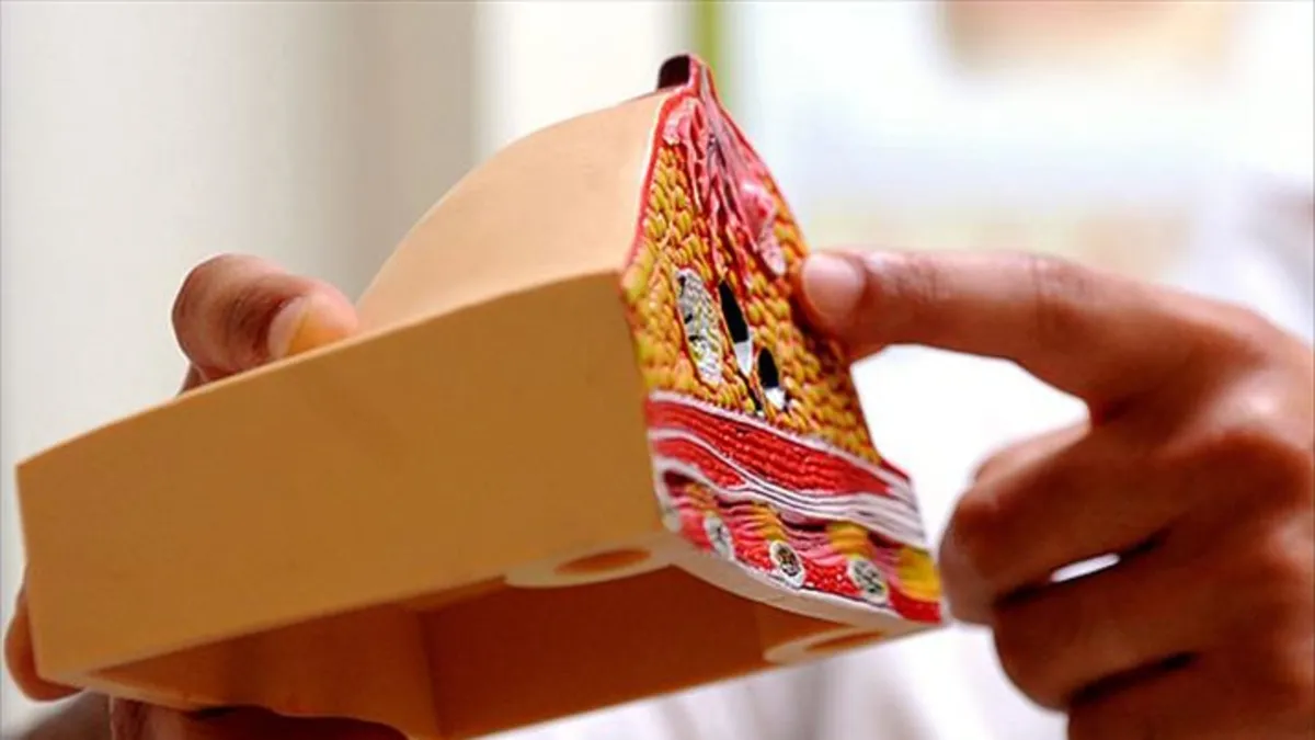 Kolesterol nasıl düşürülür? Yüksek LDL kolesterolü düşürmek için nasıl beslenmeliyim?