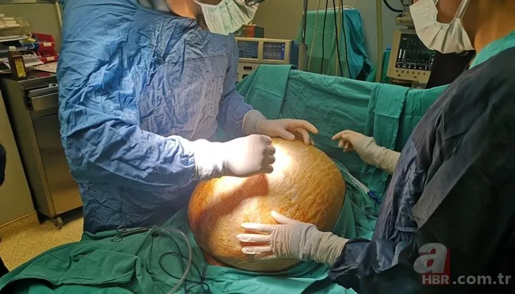 25 yaşındaki anne tümörü alınınca 91 kilodan 70 kiloya indi