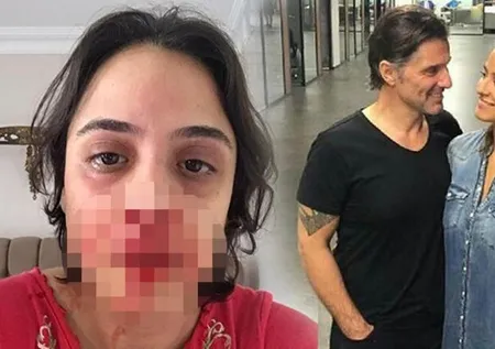 Hazım Körmükçü, Zeynep Tandoğan'a şiddet uyguladı