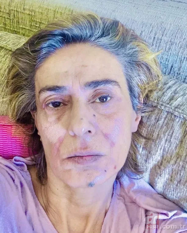 Yıldız Tilbe'nin son hali sevenlerini endişelendirdi 6