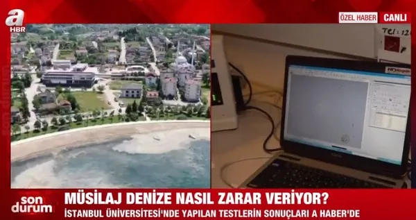 Müsilaj test sonuçları ilk kez A Haber'de! Prof. Dr. Neslihan Özdelice milyonları uyardı! - 2