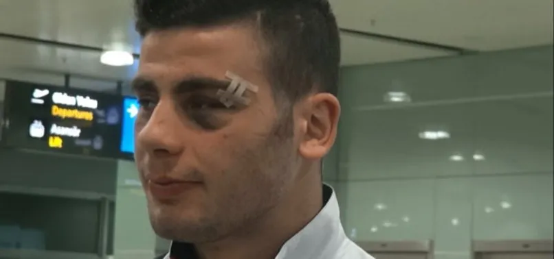 Romanya'da Türk Milli Takımı'na çirkin saldırı!