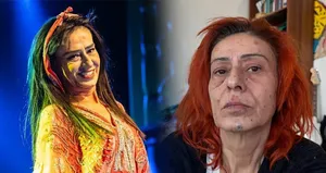 Yüzü yanmıştı! İmaj değiştirdi