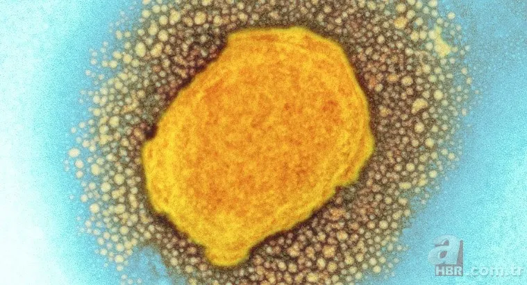 Maymun çiçek virüsü yeni salgına davetiye çıkardı! Avrupa’da vaka sayısı artışta, tedavisi yok 13