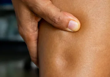 Ödem vücuttan nasıl atılır? İşte ödem söktürücü detoks içeceği...