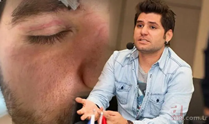 Seksenler dizisinin yıldızı Ceyhun Fersoy saldırıya uğradı! 1