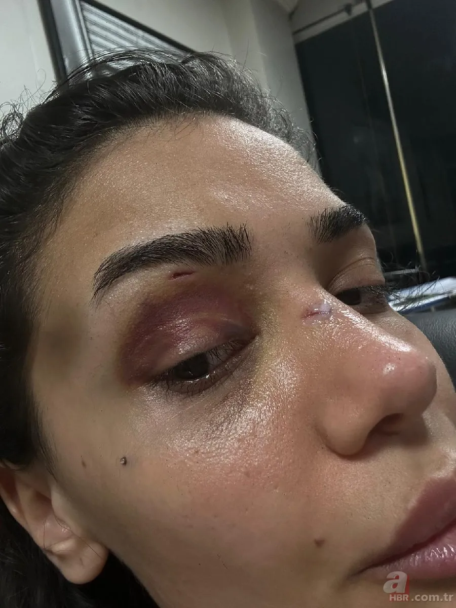 Ebru Hemşire yaşadığı dehşeti anlattı: “Ölmeden önce sesimi duyun” 6