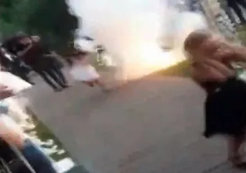 Arkadaşının düğününde kabusu yaşadı! Dizine havai fişek saplandı
