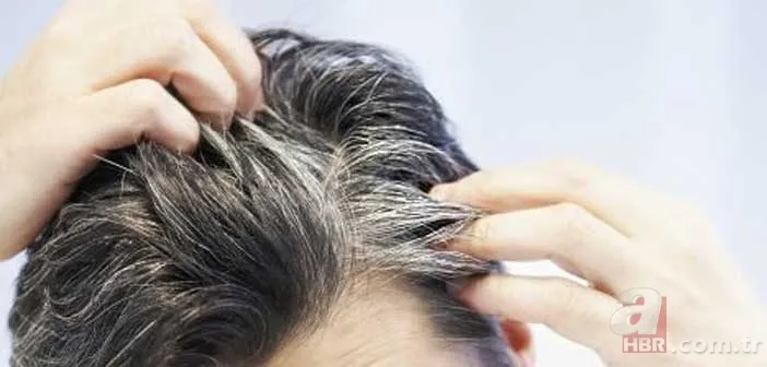 Saçınızda aniden çıkan beyaz tutamın sırrı: Poliozis nedir, neden olur? 2