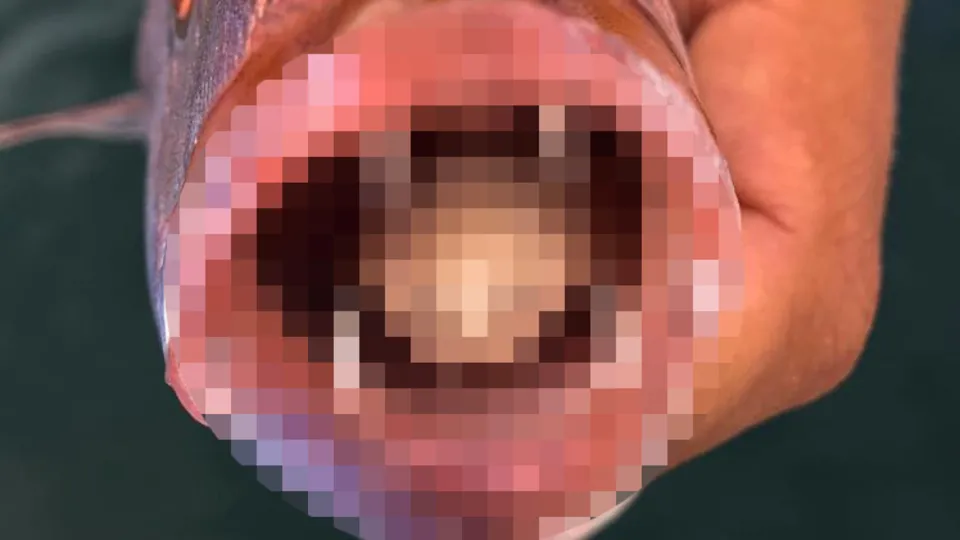Balık tutan genç hayatının şokunu yaşadı! Olta ile tuttuğu balığın ağzından çıktı