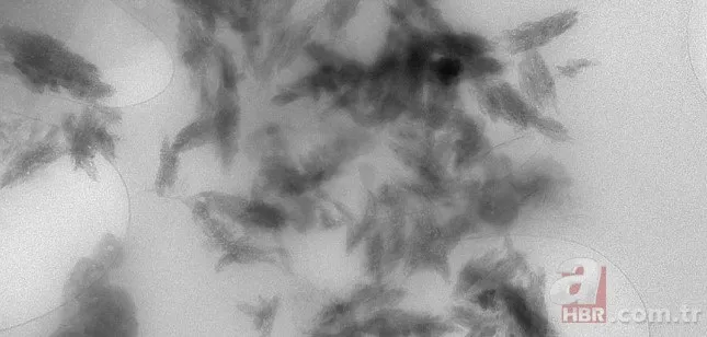 İnsan beynini bekleyen büyük tehlike! Plastikle doluyor... 4