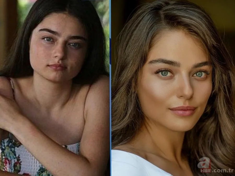 Seda Sayan'ın son hali şaşkına çevirdi! Estetik sonrası... 17