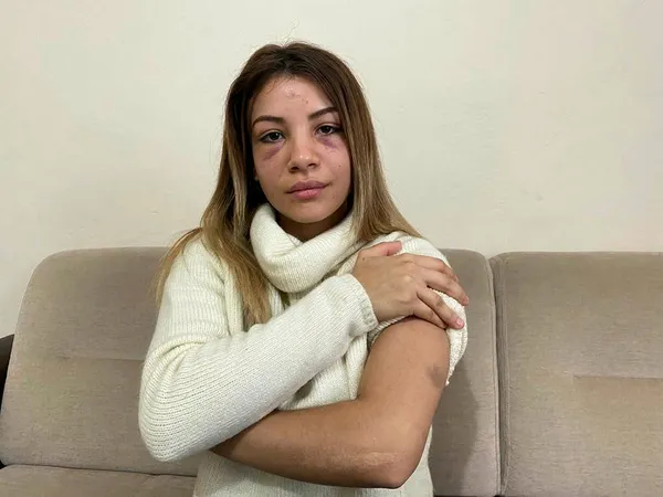 1669383325093.jpg Kocasının telefonunda 'babalık testi fiyatı' aramasını gördü! Çocuğunun yanında hamile kadını darbetti - 1