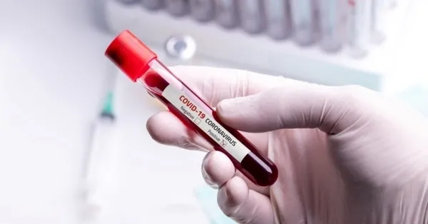 Kandaki oksijen miktarını nasıl anlarız? Uzman isim anlattı - 3