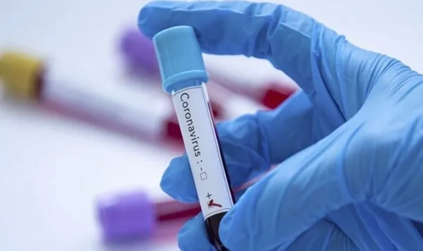 ABD'li ilaç firması Pfizer'dan koronavirüs aşısı açıklaması - 4