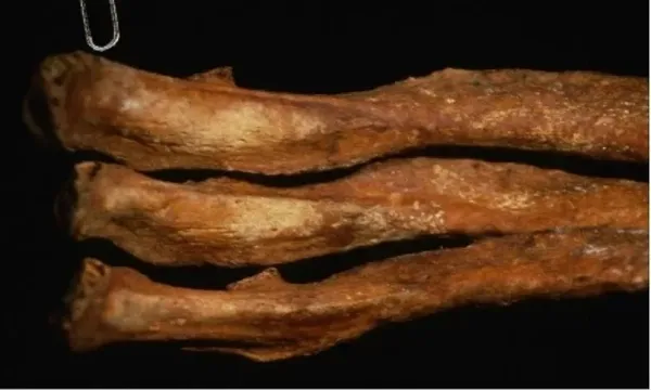 ABD’de uzun zaman önce ölmüş vampirin kimliği keşfedildi! DNA teknolojisiyle yüzü ortaya çıkartıldı