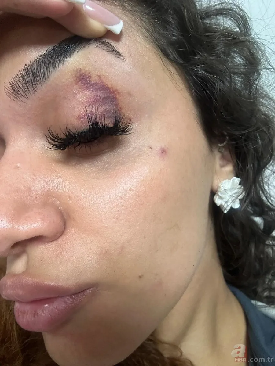 Ebru Hemşire yaşadığı dehşeti anlattı: “Ölmeden önce sesimi duyun” 2