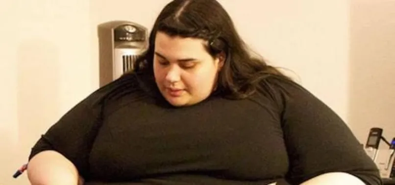 300 kiloya ulaşmıştı! Son hali şaşırttı