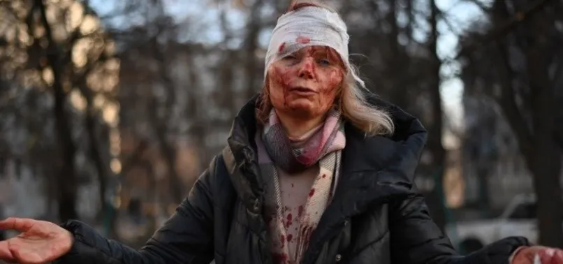 Dünya onu konuştu! Rusya-Ukrayna savaşının simgesi Olena Kurilo'dan kan donduran sözler...