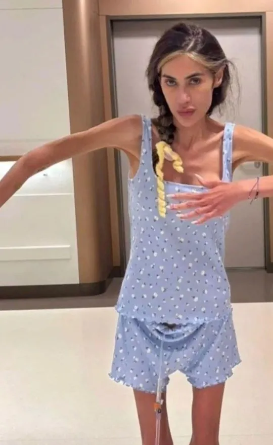 2 yıl mücadele etmiş! Derya Uluğ’dan anoreksiya itirafı! 1 dilim ekmek yiyebilmek için...