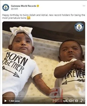 Doktorlar hiç şans vermemişti! Dünyanın en erken doğan ikizleri 1 yaşında! Guinness Rekorlar Kitabı’na girdiler