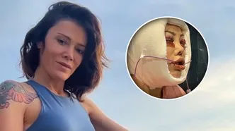Güney Kore'de yüz nakli olan Didem Ceran'ın son hali