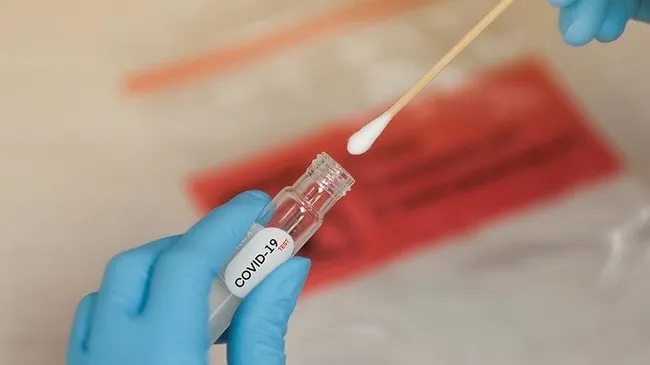 Antalya Valisi Ersin Yazıcı’dan vatandaşlara koronavirüs çağrısı: İhbar edin