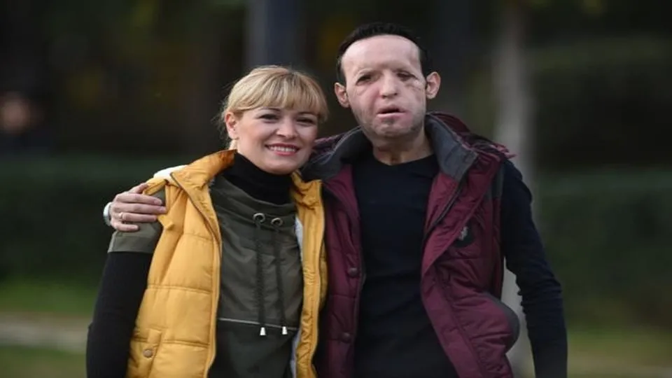 recep sert in kazadan onceki hali