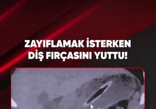 ZAYIFLAMAK İSTERKEN DİŞ FIRÇASINI YUTTU