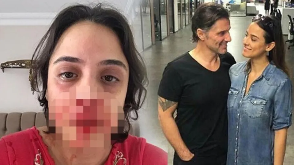 Şiddet haberleriyle gündem olan Hazım Körmükçü ve Zeynep Tandoğan barıştı