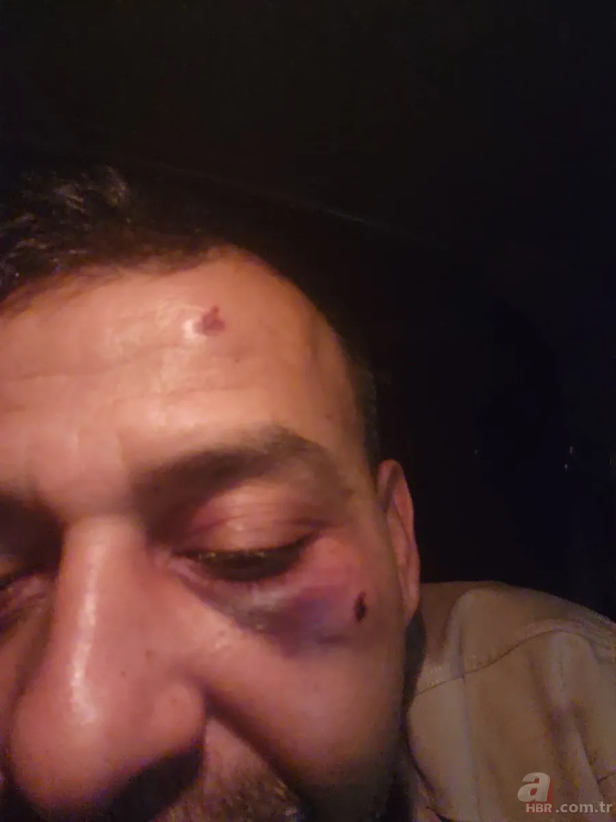 Sosyal medya fenomenine kanlı pusu! Hırsızlık süsüyle tuzağa çektiler: Öleceğini zannedip şehadet getirdi 6