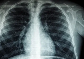 "Nasıl olsa geçer" demeyin! Bu belirtiler kanserin habercisi olabilir