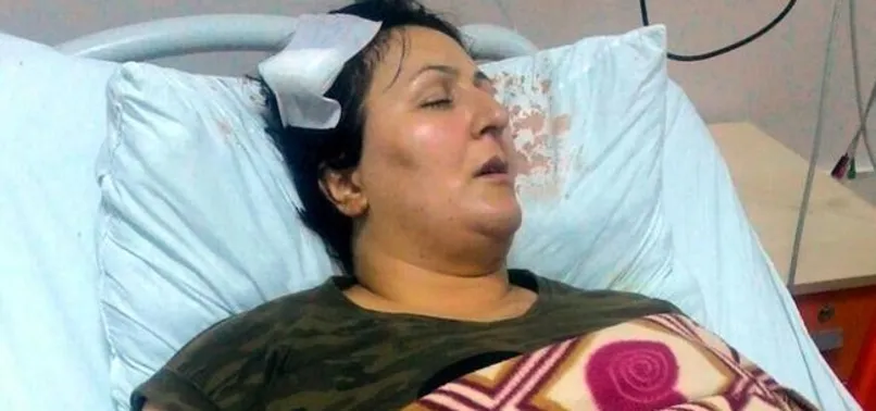 Komşusu beyzbol sopasıyla bu hale getirdi