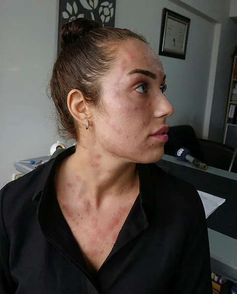 İzmir’de gençlik aşısı yaptıran Seline Ferah Çalışkan: Nefes alamadım - 1