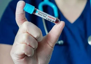 ABD'de 24 saatlik koronavirüs bilançosu: 304 kişi hayatını kaybetti