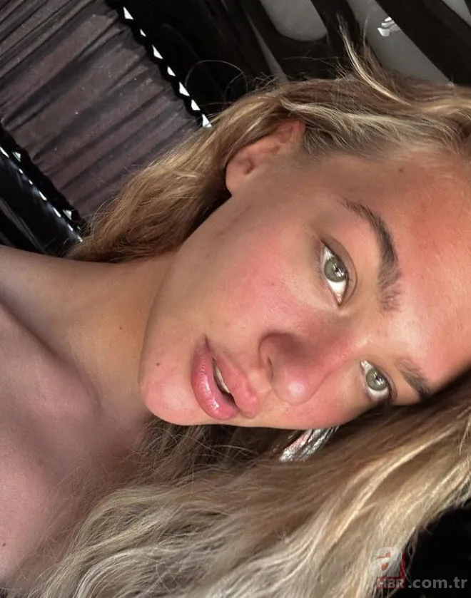 Estetikle bambaşka biri olmuştu! Melisa Döngel’in makyajsız hali olay 4