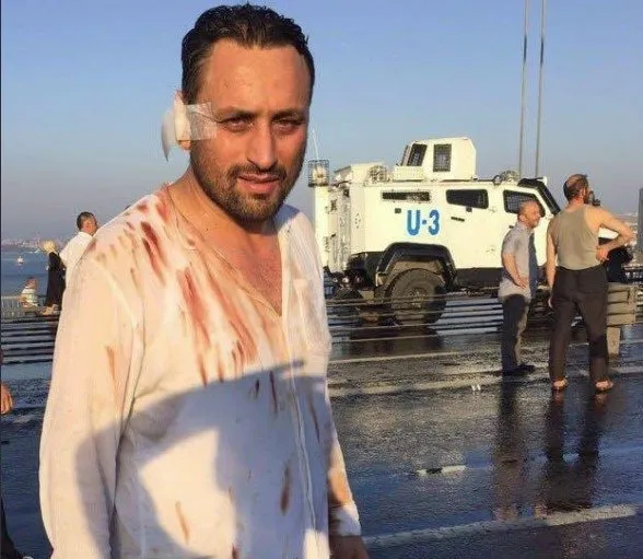 CHP’li İBB 15 Temmuz gazisini mobing uygulayarak istifa ettirdi! AK Parti’den sert tepki geldi: Zulüm var