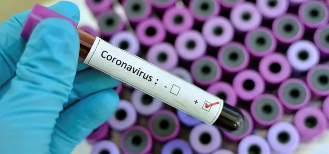 Koronavirüs ABD’yi de vurdu! Devlet tahvili getirisi...