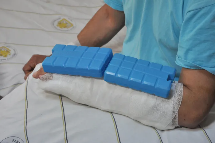 Dünyada çok nadir görülüyor! 'Kist hidatik' ameliyatı Diyarbakır'da yapıldı | 'Kist hidatik' nedir? - 3