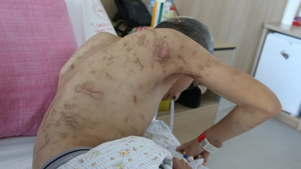 Ankara'da facia! 12 yaşındaki çocuk 10 köpeğin saldırısına uğradı