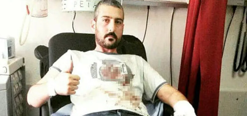 Vatan uğruna 6 yıldır şarapnel parçalarıyla yaşıyor! 15 Temmuz'da yaşadıklarını anlattı