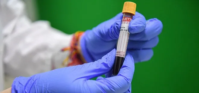 Kan grubu ile koronavirüs arasında bağlantı var mı? 100 bin kişilik büyük deney sonuçlandı