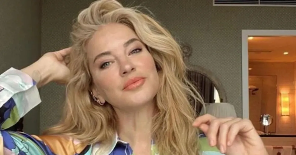 Burcu Esmersoy gönülleri fethetti! Görme kaybı olan köpeği...