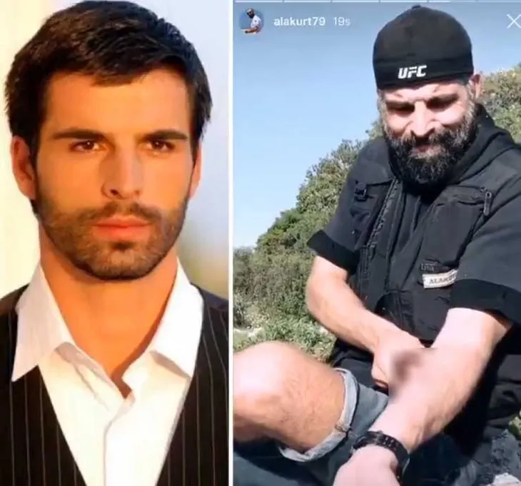 Oyuncu Mehmet Akif Alakurt kolunu kesip sosyal medyada paylaştı