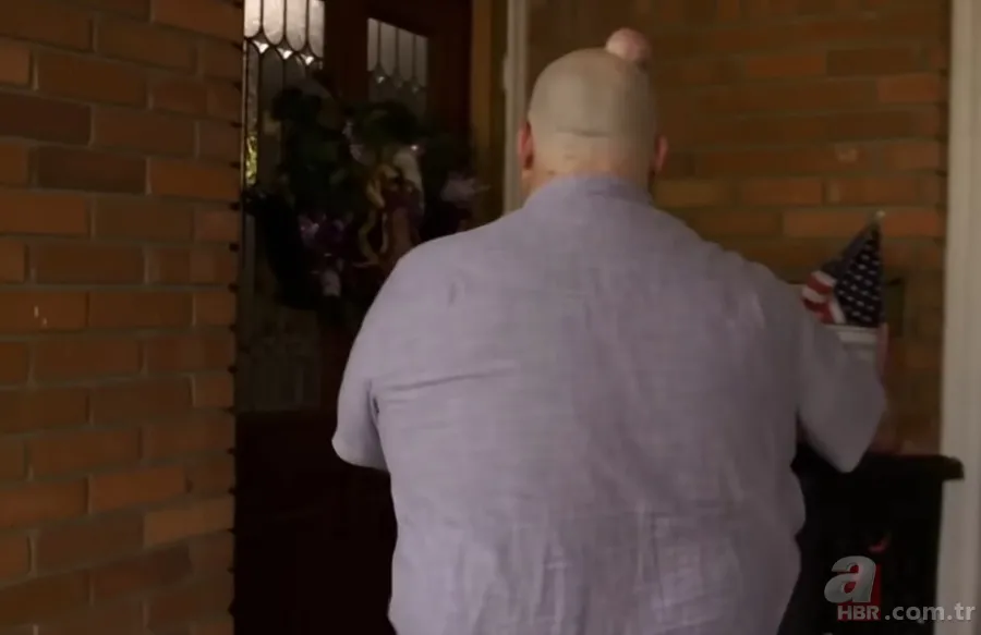 Sokağa şapka ile çıkıyordu! Başındaki şişlikten bakın ne çıktı 👩⚕️ Görenleri şaşkına çeviren olay 21