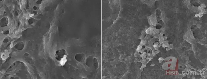 İnsan beynini bekleyen büyük tehlike! Plastikle doluyor... 2