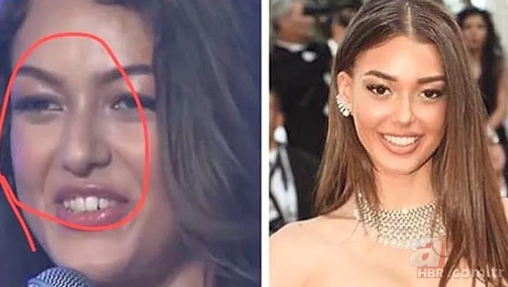 Seda Sayan'ın son hali şaşkına çevirdi! Estetik sonrası... 21