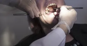 Diş tedavisinde yapay zeka çağı